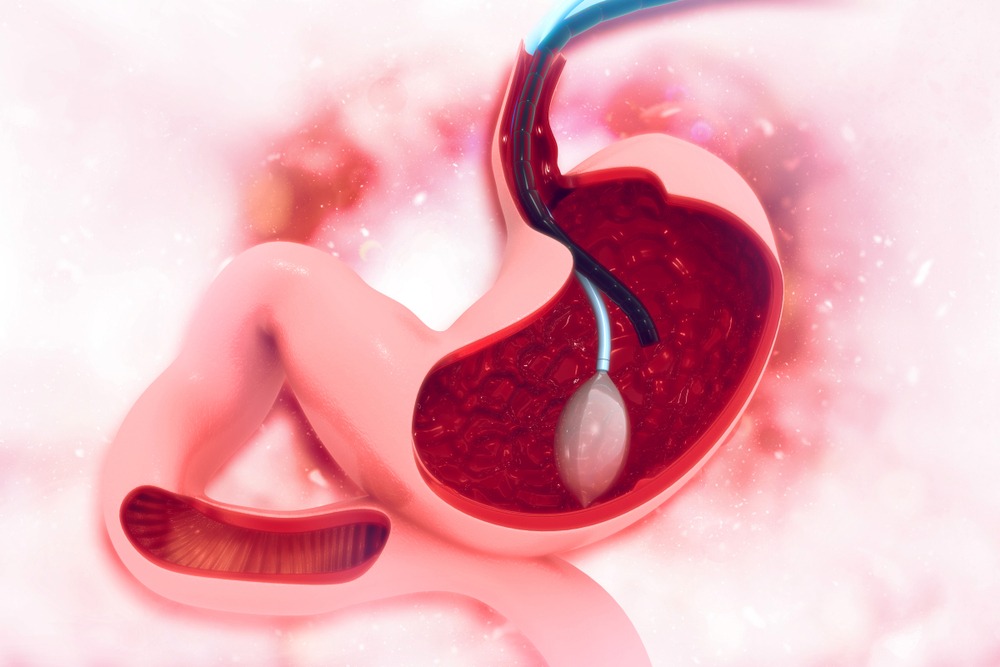 Gastroenterología-Romeros Digestive
